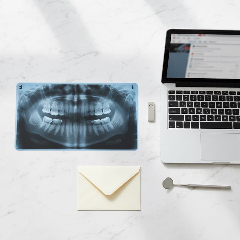 How to Get Your X-Rays Sent to a Clinic Abroad